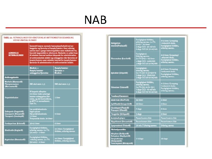 NAB 