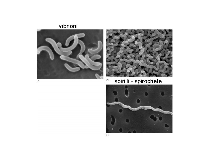 vibrioni spirilli - spirochete 