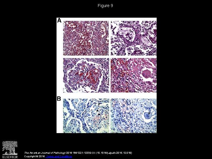 Figure 9 The American Journal of Pathology 2016 1861221 -1233 DOI: (10. 1016/j. ajpath.