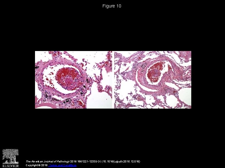 Figure 10 The American Journal of Pathology 2016 1861221 -1233 DOI: (10. 1016/j. ajpath.