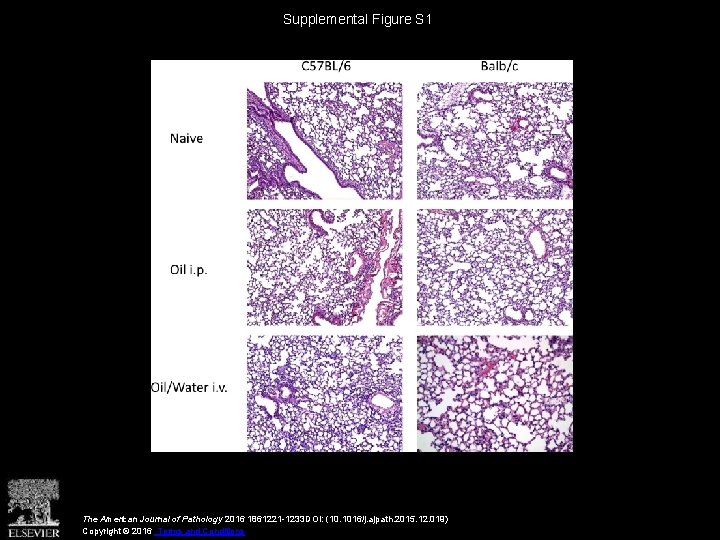 Supplemental Figure S 1 The American Journal of Pathology 2016 1861221 -1233 DOI: (10.