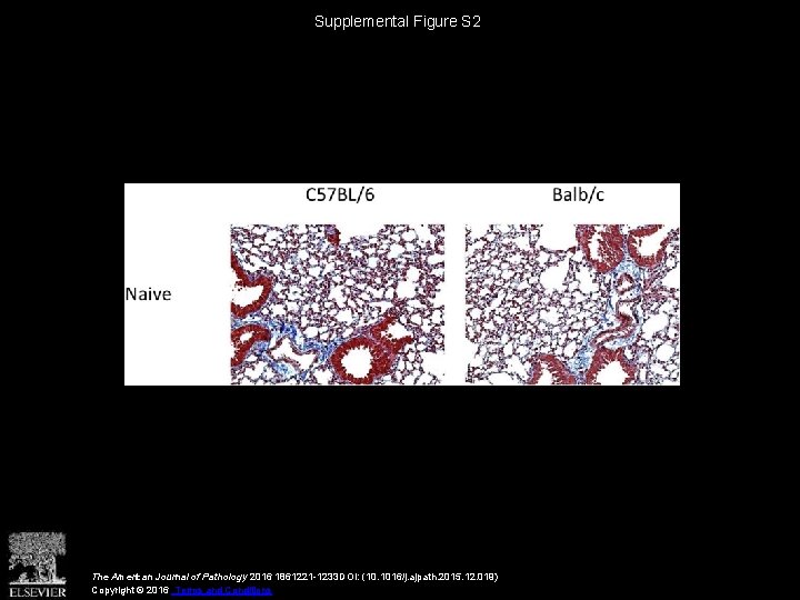Supplemental Figure S 2 The American Journal of Pathology 2016 1861221 -1233 DOI: (10.