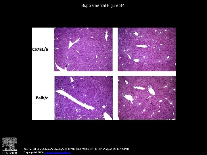 Supplemental Figure S 4 The American Journal of Pathology 2016 1861221 -1233 DOI: (10.