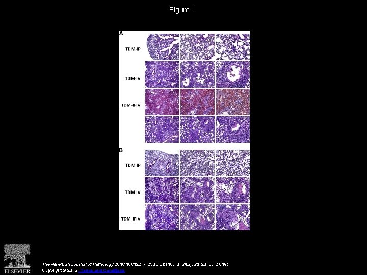 Figure 1 The American Journal of Pathology 2016 1861221 -1233 DOI: (10. 1016/j. ajpath.