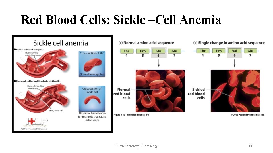 Red Blood Cells: Sickle –Cell Anemia Human Anatomy & Physiology 14 