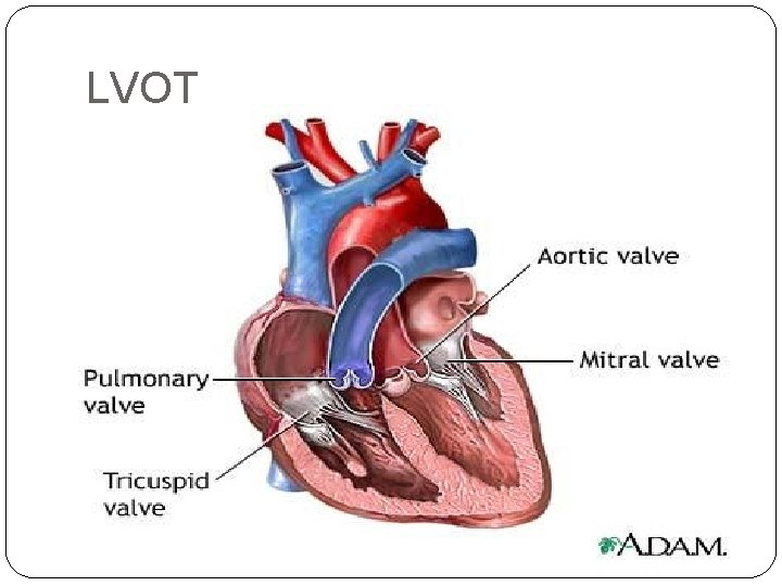 LVOT 