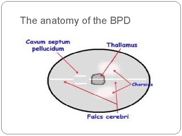 The anatomy of the BPD 