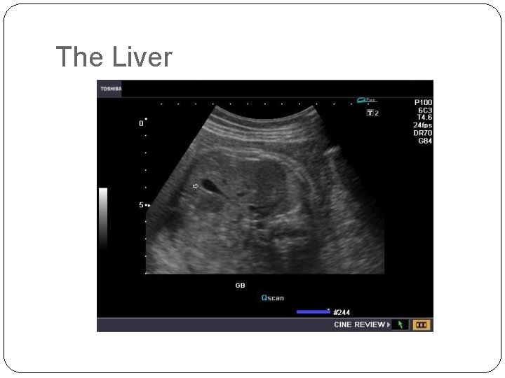 The Liver 