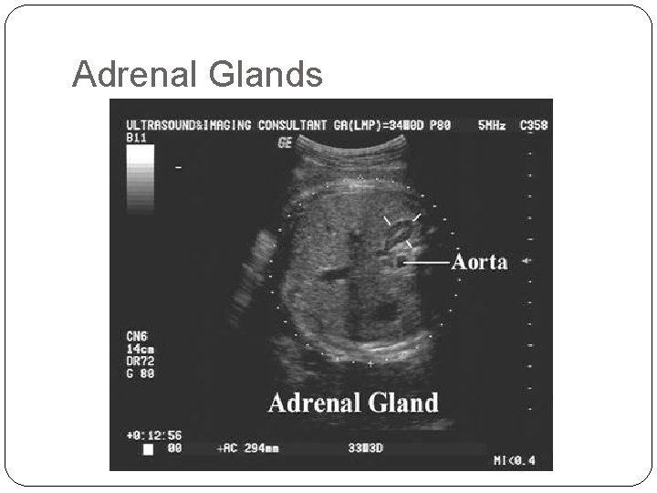 Adrenal Glands 