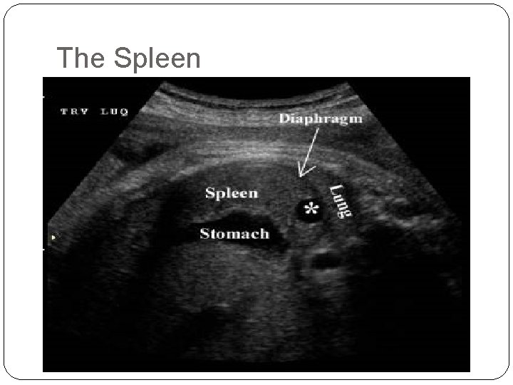 The Spleen 