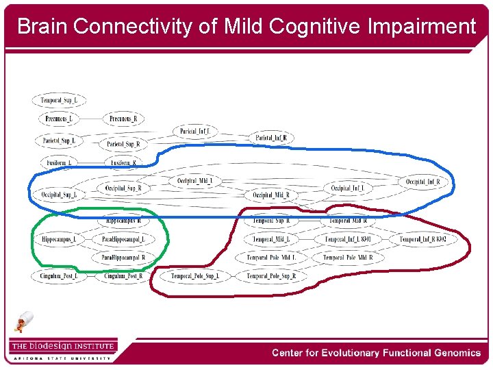 Brain Connectivity of Mild Cognitive Impairment 