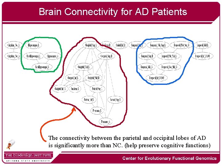 Brain Connectivity for AD Patients The connectivity between the parietal and occipital lobes of