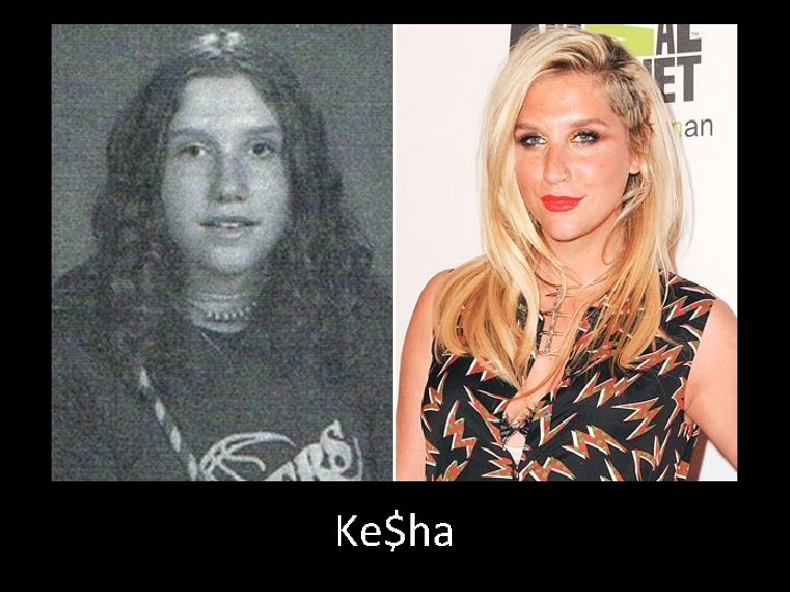 Ke$ha 