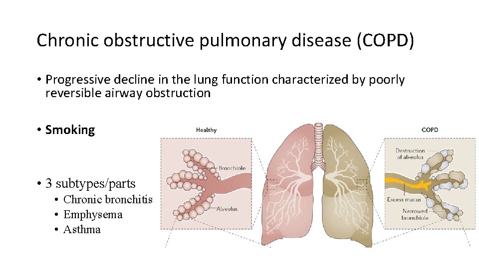 Chronic obstructive pulmonary disease (COPD) • Progressive decline in the lung function characterized by