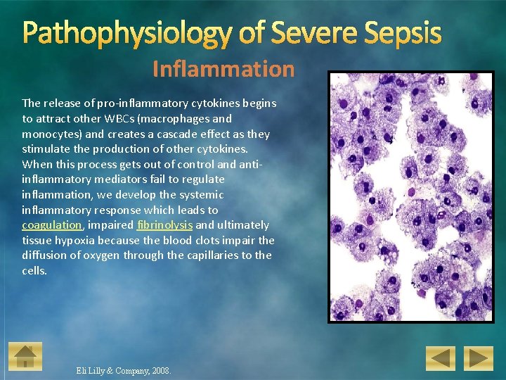 Pathophysiology of Severe Sepsis Inflammation The release of pro-inflammatory cytokines begins to attract other