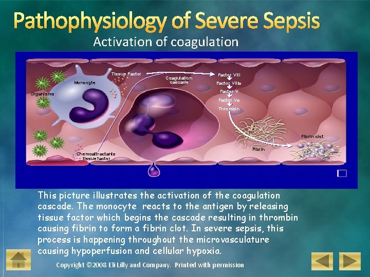 Pathophysiology of Severe Sepsis Activation of coagulation Tissue Factor Monocyte Coagulation cascade Factor VIIIa