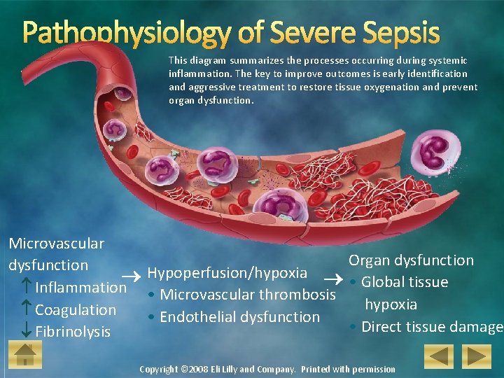 Pathophysiology of Severe Sepsis This diagram summarizes the processes occurring during systemic inflammation. The