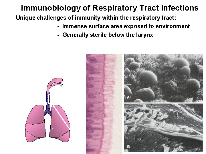 Immunobiology of Respiratory Tract Infections Unique challenges of immunity within the respiratory tract: -