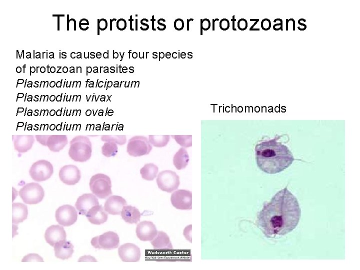 The protists or protozoans Malaria is caused by four species of protozoan parasites Plasmodium
