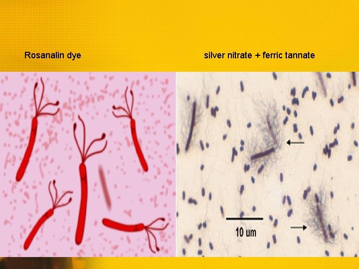 Rosanalin dye silver nitrate + ferric tannate 
