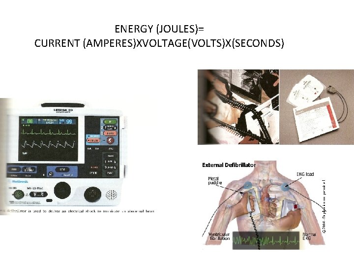 ENERGY (JOULES)= CURRENT (AMPERES)XVOLTAGE(VOLTS)X(SECONDS) 