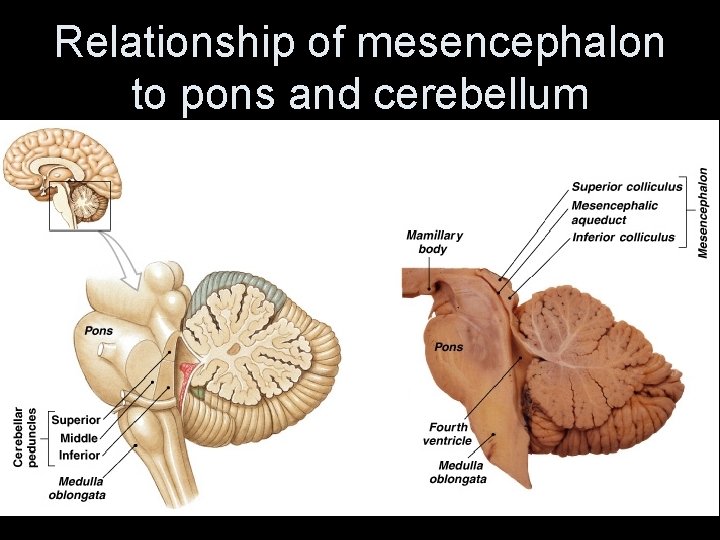 Relationship of mesencephalon to pons and cerebellum 