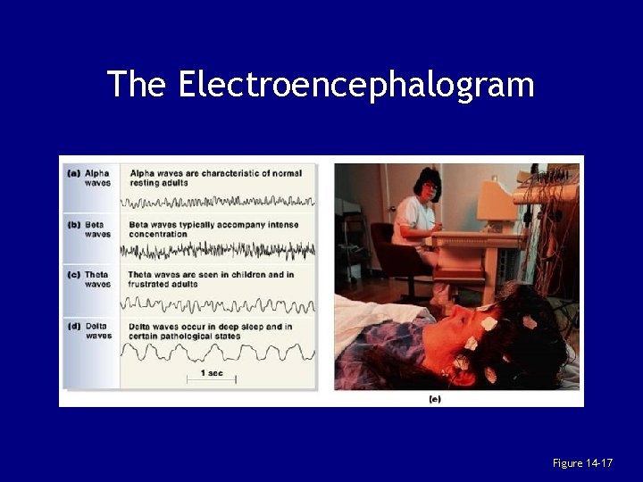 The Electroencephalogram Figure 14– 17 