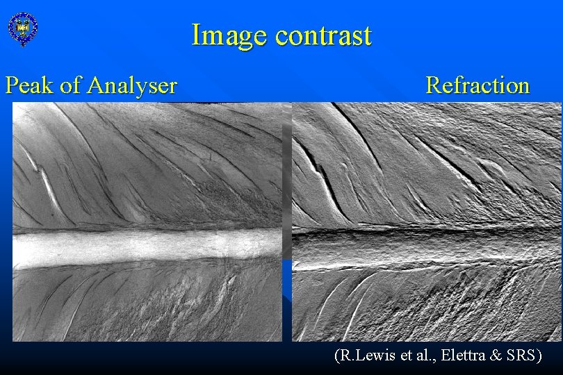 Image contrast Peak of Analyser Refraction (R. Lewis et al. , Elettra & SRS)