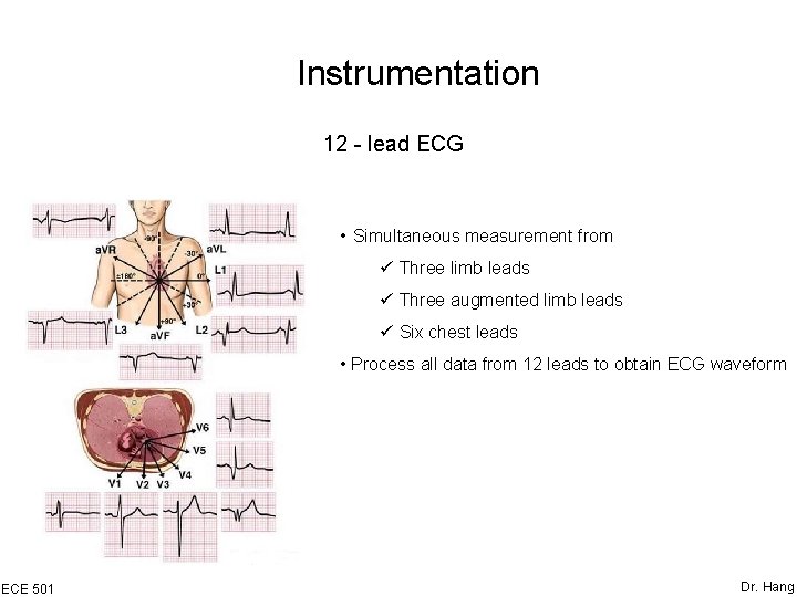 Instrumentation 12 - lead ECG • Simultaneous measurement from ü Three limb leads ü