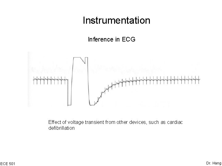Instrumentation Inference in ECG Effect of voltage transient from other devices, such as cardiac