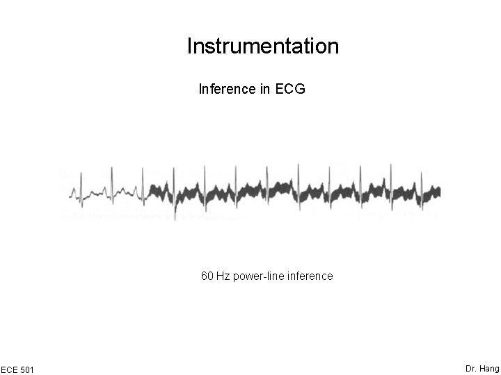 Instrumentation Inference in ECG 60 Hz power-line inference ECE 501 Dr. Hang 