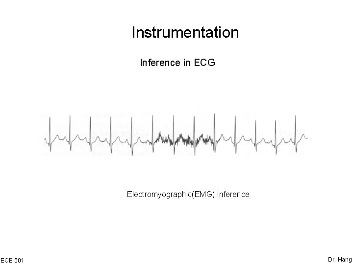 Instrumentation Inference in ECG Electromyographic(EMG) inference ECE 501 Dr. Hang 