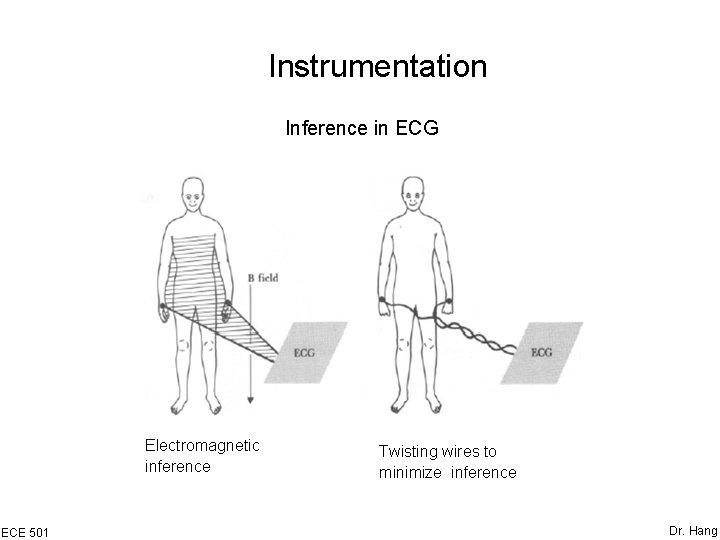 Instrumentation Inference in ECG Electromagnetic inference ECE 501 Twisting wires to minimize inference Dr.