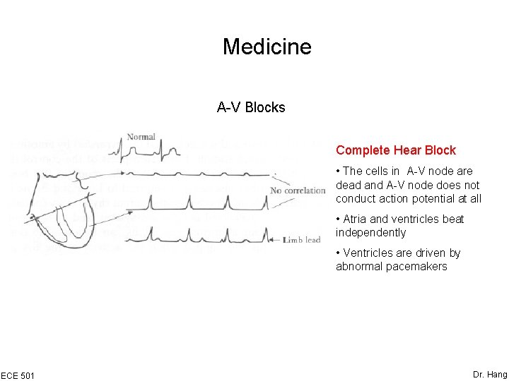 Medicine A-V Blocks Complete Hear Block • The cells in A-V node are dead