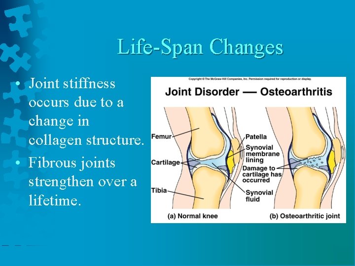 Life-Span Changes • Joint stiffness occurs due to a change in collagen structure. •