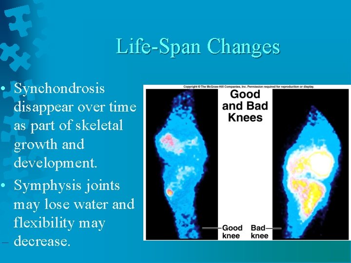 Life-Span Changes • Synchondrosis disappear over time as part of skeletal growth and development.