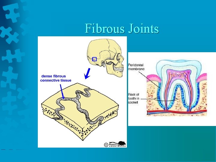 Fibrous Joints 