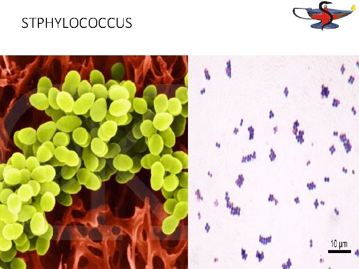 STPHYLOCOCCUS 