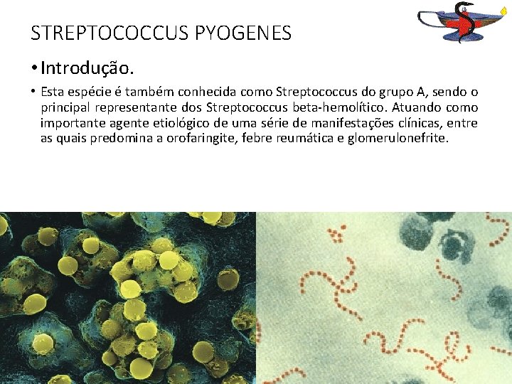 STREPTOCOCCUS PYOGENES • Introdução. • Esta espécie é também conhecida como Streptococcus do grupo