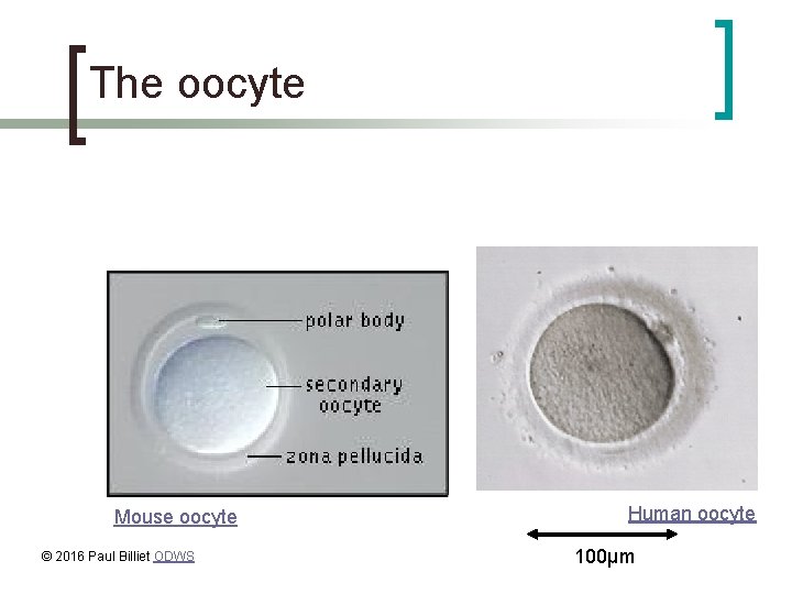 The oocyte Mouse oocyte © 2016 Paul Billiet ODWS Human oocyte 100µm 