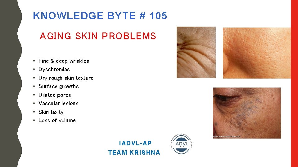 KNOWLEDGE BYTE # 105 AGING SKIN PROBLEMS • • Fine & deep wrinkles Dyschromias