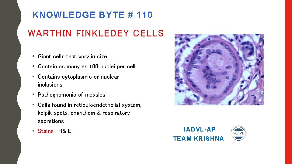 KNOWLEDGE BYTE # 110 WARTHIN FINKLEDEY CELLS • Giant cells that vary in size
