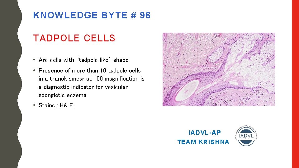 KNOWLEDGE BYTE # 96 TADPOLE CELLS • Are cells with ‘tadpole like’ shape •