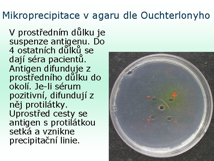 Mikroprecipitace v agaru dle Ouchterlonyho V prostředním důlku je suspenze antigenu. Do 4 ostatních