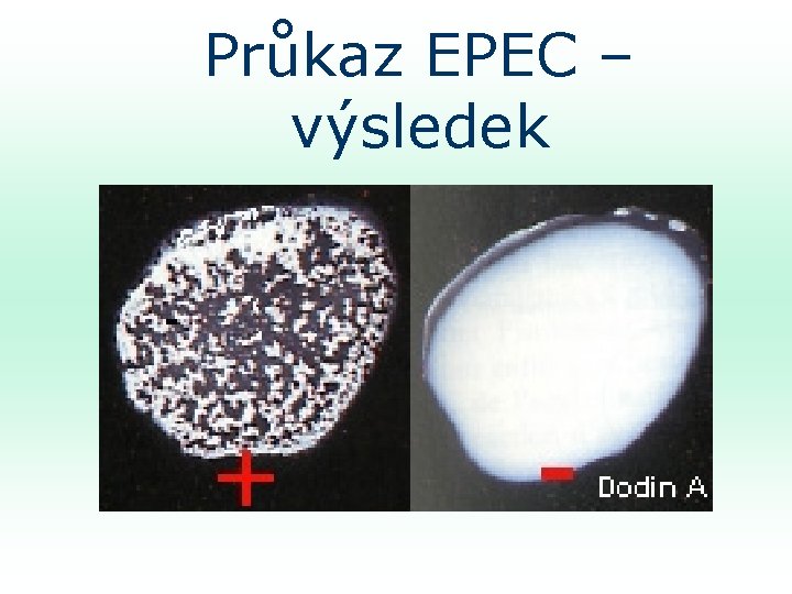 Průkaz EPEC – výsledek 