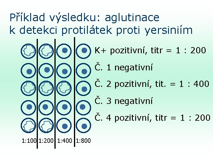 Příklad výsledku: aglutinace k detekci protilátek proti yersiniím K+ pozitivní, titr = 1 :