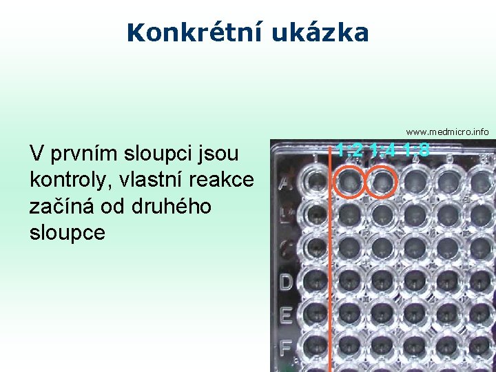 Konkrétní ukázka www. medmicro. info V prvním sloupci jsou kontroly, vlastní reakce začíná od