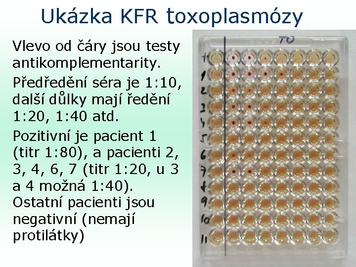 Ukázka KFR toxoplasmózy Vlevo od čáry jsou testy antikomplementarity. Předředění séra je 1: 10,