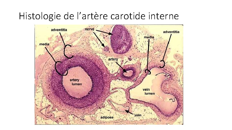 Histologie de l’artère carotide interne 