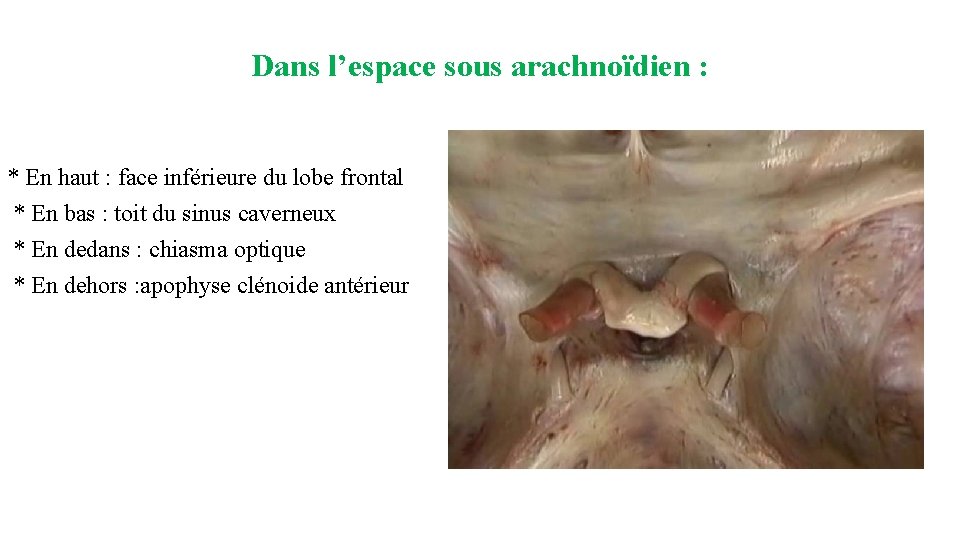 Dans l’espace sous arachnoïdien : * En haut : face inférieure du lobe frontal